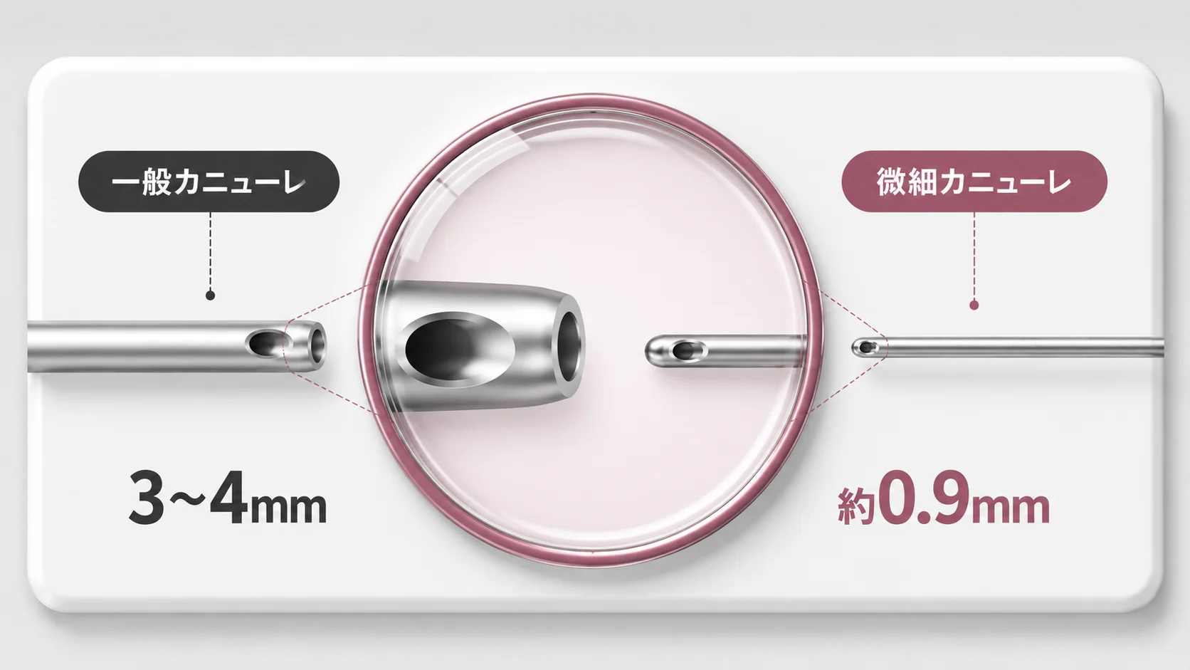 一般カニューレ（3〜4mm）と微細カニューレ（約0.9mm）の太さ比較｜OLO美容外科