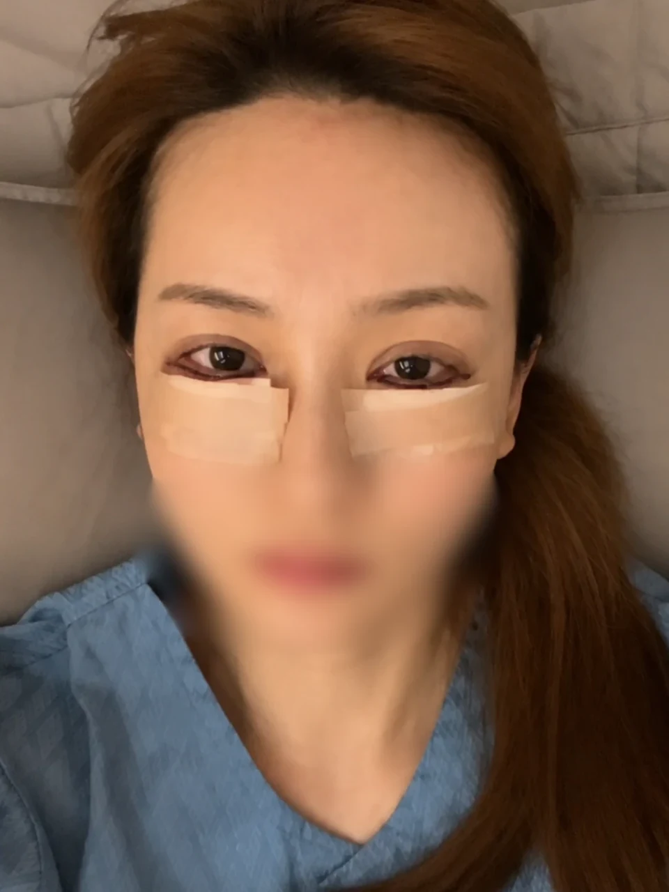 手術当日、ガウンを着て準備完了(プライバシー処理)